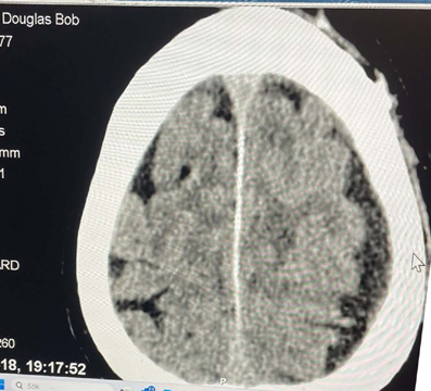 Brain image courtesy of the author.