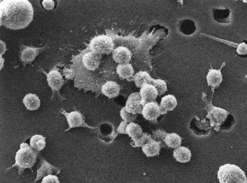 Photo by Dr. Raowf Guirguis. National Cancer Institute at Wikimedia Commons.